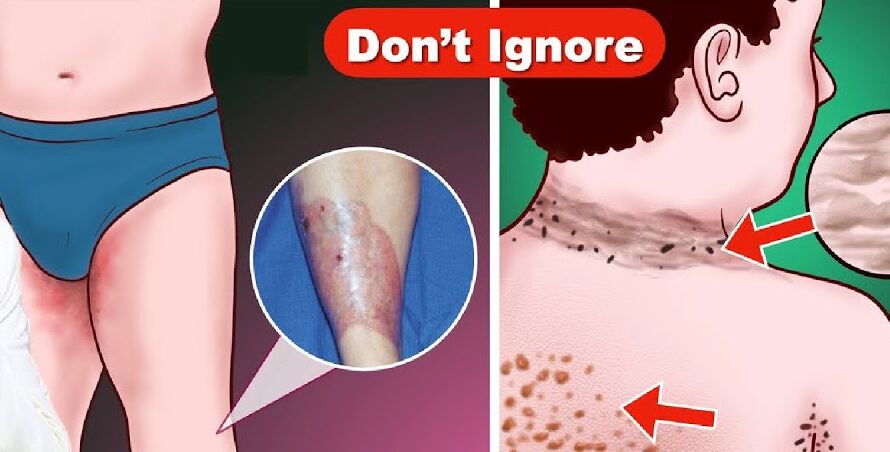 Kidney disease early detection – Consult a doctor